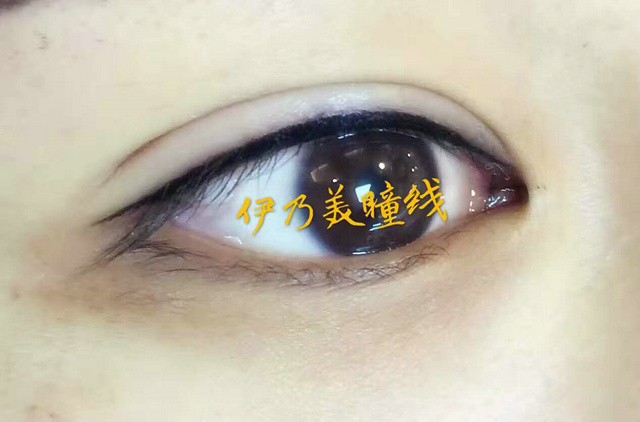 伊乃美瞳線(xiàn)